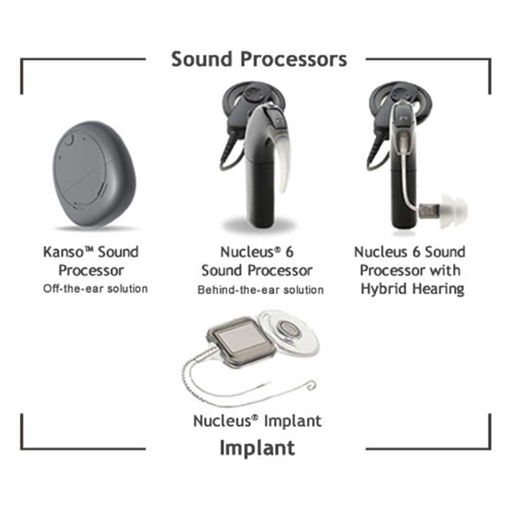Cochlear SPS Implant